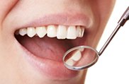 歯と歯茎の健康診断