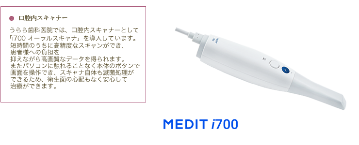 口腔内スキャナ
