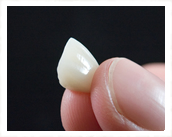 オールセラミッククラウン